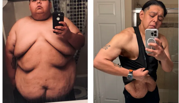 Omar Gomez weight loss