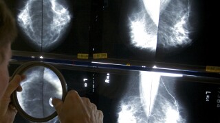 New recommended age for breast cancer screenings